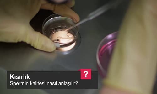 Spermin Kalitesi Nasıl Anlaşılır