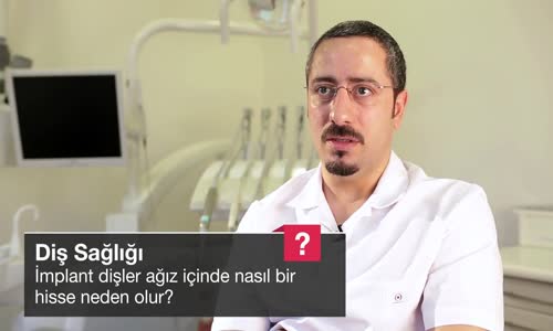 İmplant Dişler Ağız İçinde Nasıl Bir Hisse Neden Olur