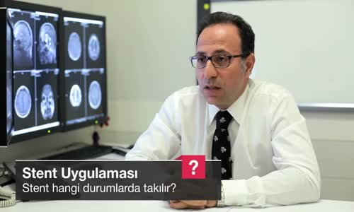 Stent Hangi Durumlarda Takılır