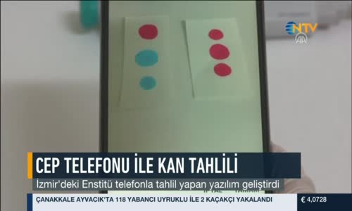 Cep Telefonu Kan Tahlili Yapabilecek 