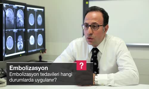 Embolizasyon Tedavileri Hangi Durumlarda Uygulanır