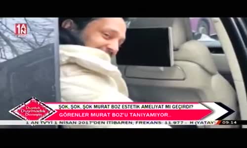 Murat Boz Estetik Ameliyat Mı Geçirdi! 