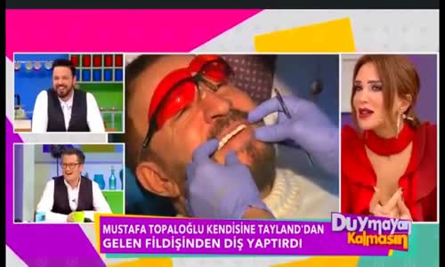 Mustafa Topaloğlu Ağzına Fildişi Taktırdı!!