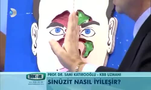 Sinüzit Nasıl İyileşir