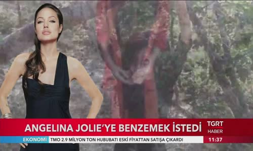 Angelina Jolie Olmak İsterken Gollum Olan İranlı Kadın