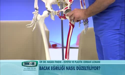 Bacak Eğriliği Neden Olur