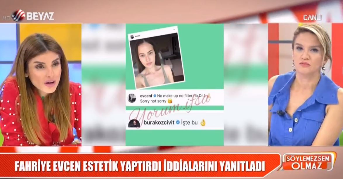 Fahriye Evcen Estetik Yaptırdı İddialarına Cevap Verdi