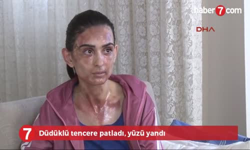 Düdüklü Tencere Patladı, Yüzü Yandı