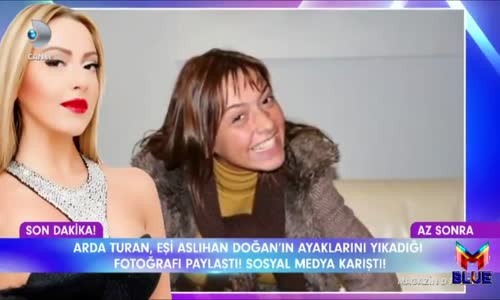 Fahriye Evcen Hadise Aleyna Tilki Almeda Abazi Gökçe Bahadır Dudaklarına Dolgu Yaptıran Ünlüler 