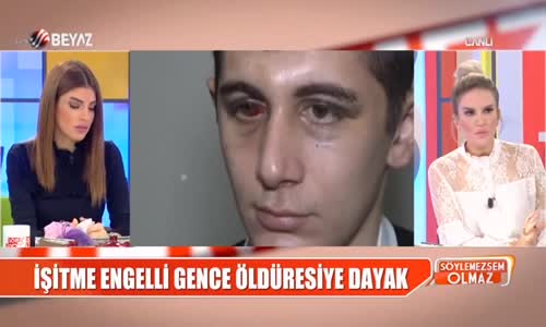 İşitme Engelli Gence Öldüresiye Dayak