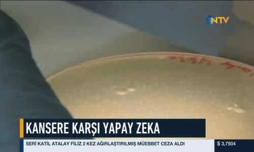 Yapay Zekayla Kanser Tanısı 