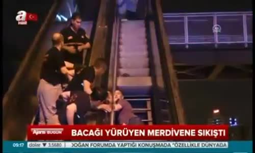 Bacağı Yürüyen Merdivene Sıkıştı