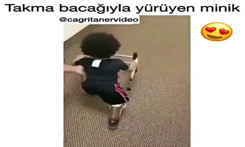 Takma Bacaklarıyla Yürüyen Minik