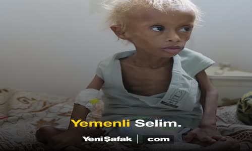 Açlığın Sembolü Yemenli Selim