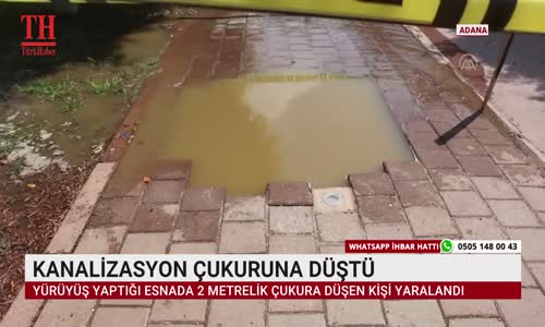 KANALİZASYON ÇUKURUNA DÜŞTÜ