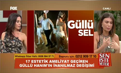 17 Ameliyat Sonrası İnanılmaz Değişim 