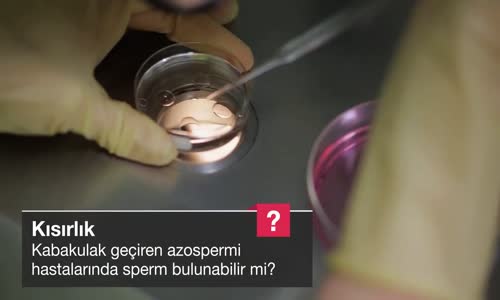 Kabakulak Geçiren Azospermi Hastalarında Sperm Bulunabilir Mi