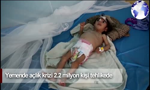 Dünya Haber: Yemende Yarım Milyon Çocuk Ölüm Tehlikesiyle Karşı Karşıya