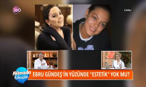 Ebru Gündeş'ten Yüzüme Sadece Botoks Yaptırdım Estetik Yok Açıklaması