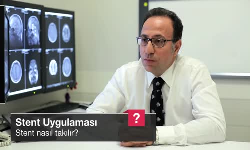 Stent Nasıl Takılır