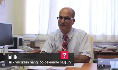 İsilik Vücudun Hangi Bölgelerinde Oluşur