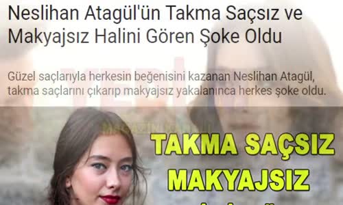 Neslihan Atagül Takma Saçsız ve Makyajsız Hali ile Herkesi Şoke Etti