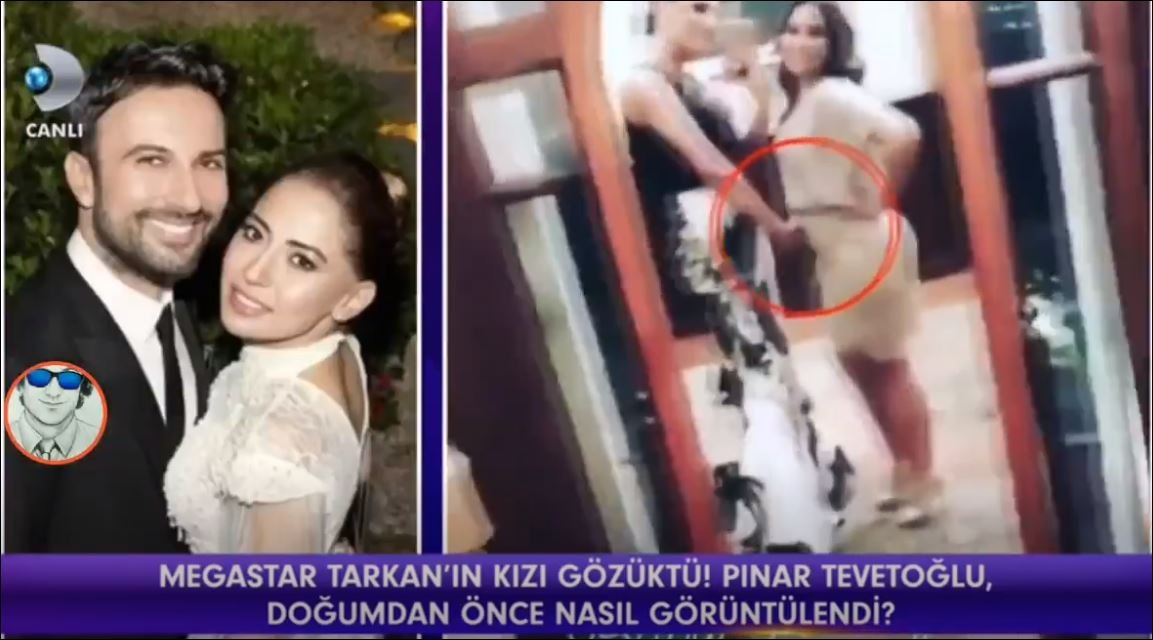 Tarkan'ın Karısı Pınar Tevetoğlu Doğumdan Önce Nasıl Görüntülendi