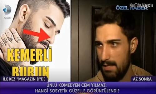 İdo Tatlıses Burun Ameliyatı Sonrası İlk Kez Magazin D'ye Konuştu 30 Mart 2018