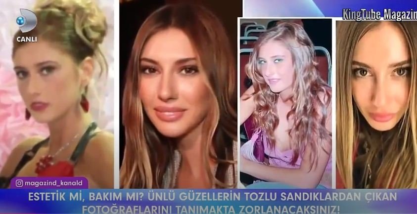 Ünlü Güzellerin Değişim Öncesine Ait Yakmak İstedikleri Fotoğrafları 15 Nisan 2018