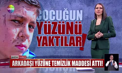 Arkadaşı yüzüne temizlik maddesi attı!