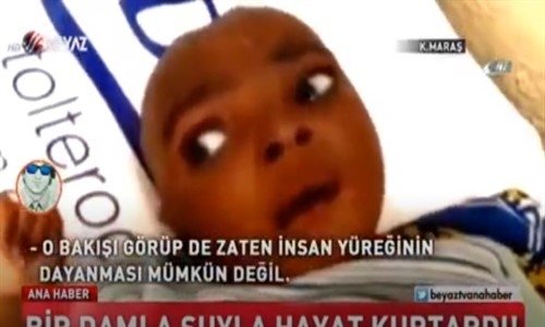 Bir Damla Suyla Hayat Kurtaran Kahraman Türk Doktoru Konuştu