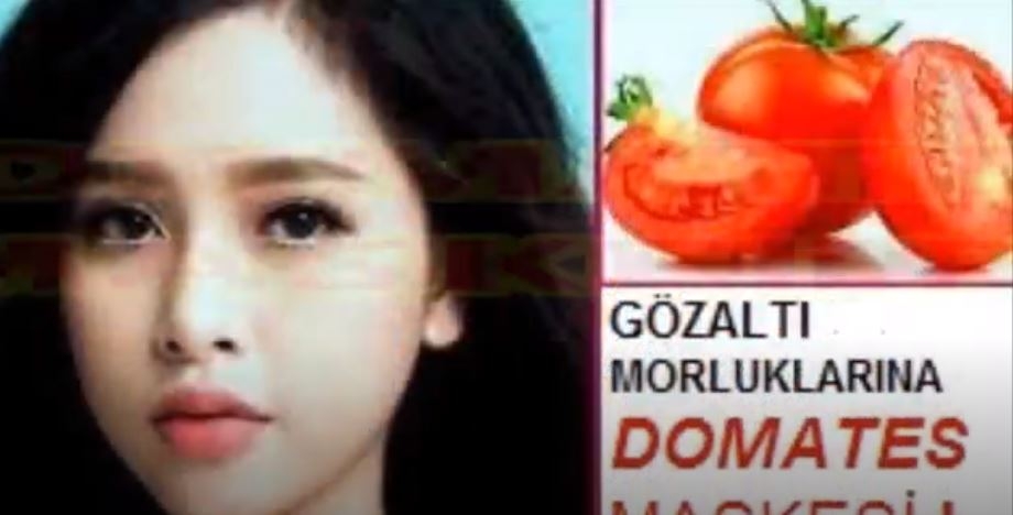 Göz Altı  Morluklarına Son Cilt Beyazlatıcı Domates  Domates Şeker Peeling  Domatesli Buz