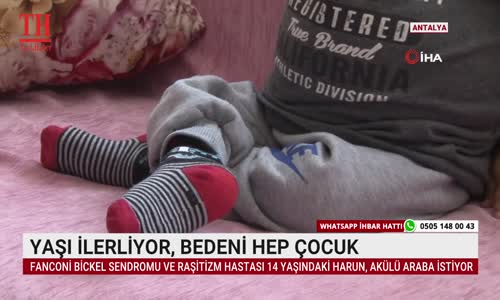 YAŞI İLERLİYOR, BEDENİ HEP ÇOCUK