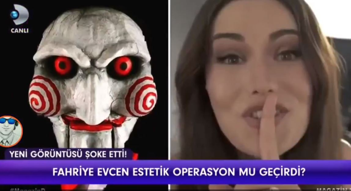 Fahriye Evcen Estetik Kurbanı Mı Oldu Yeni Halini Kime Benzettiler