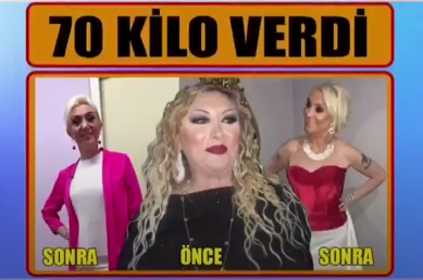 Görenler Tanıyamadı! Şarkıcı Güllü 9 Ayda 49 Kilo Verdi!