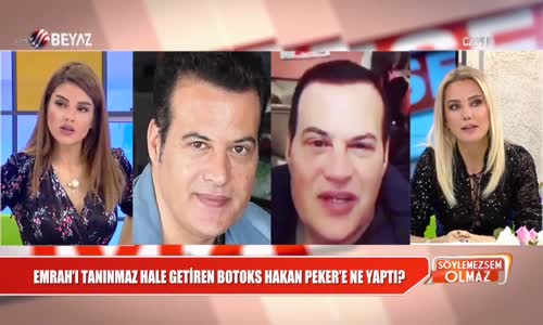 Hakan Peker'in Yüzüne Ne Oldu Canlı Yayına Bağlandı Gerçeği Açıkladı 