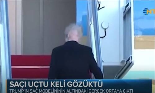 Trump'ın Gün Yüzüne Çıkan Kelliği