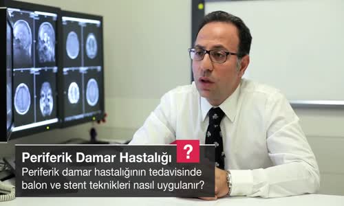 Periferik Damar Hastalığının Tedavisinde Balon Ve Stent Teknikleri Nasıl Uygulanır