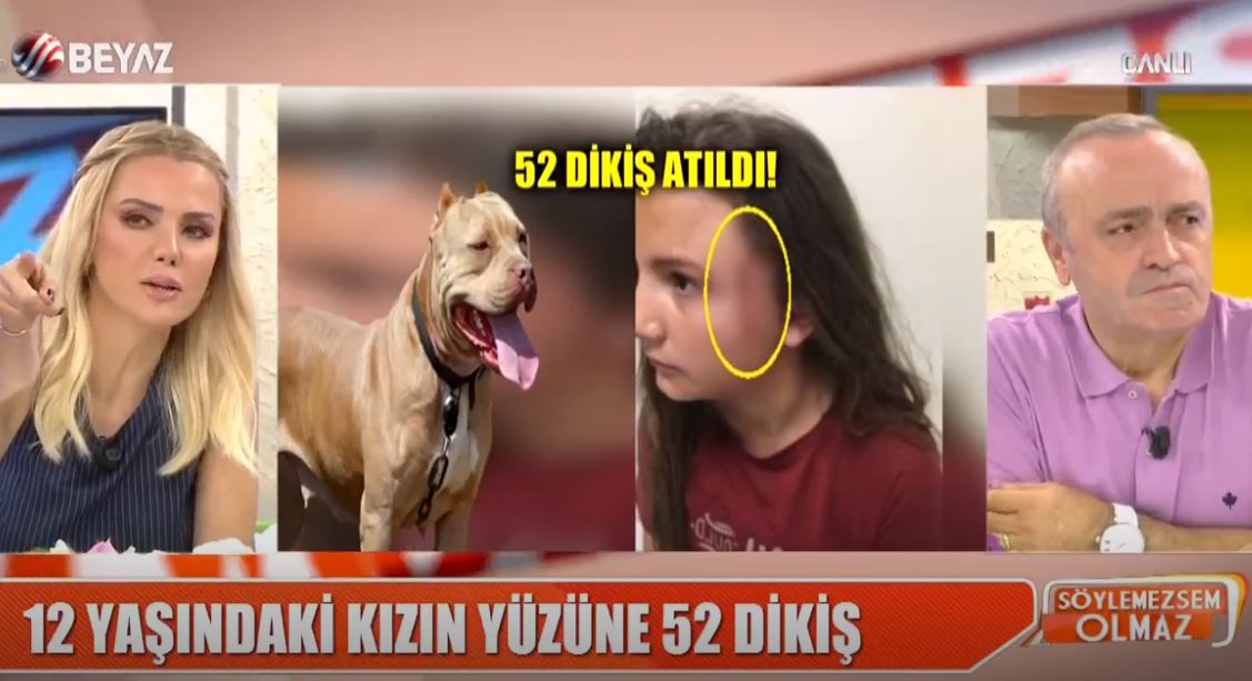 Pitbull Vahşeti Nasıl Son Bulacak