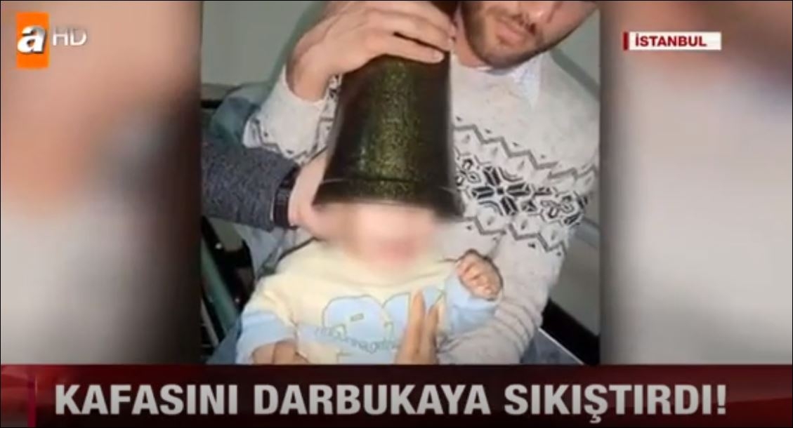 Darbukaya Kafası Sıkışan Çocuk